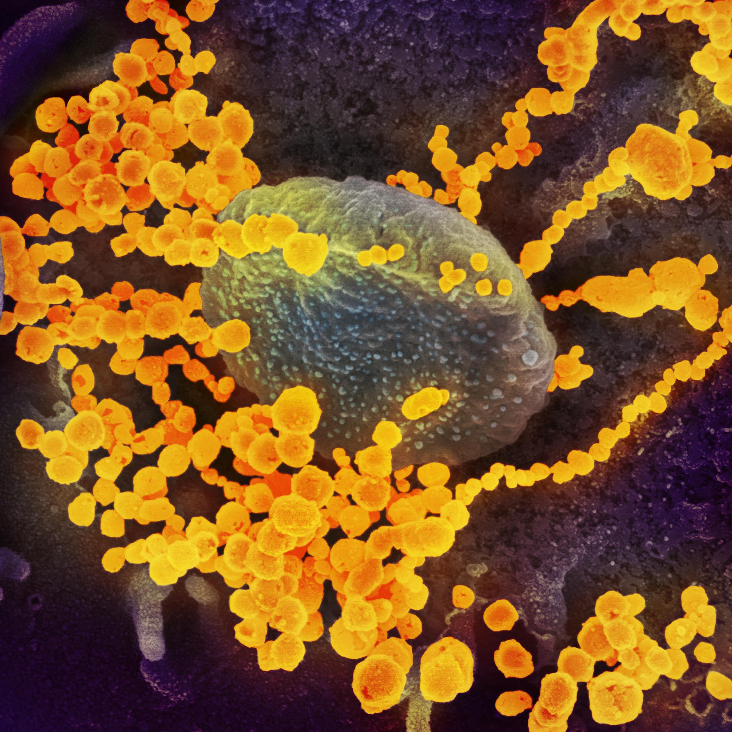 Comment notre corps se défend-il contre les envahisseurs ?