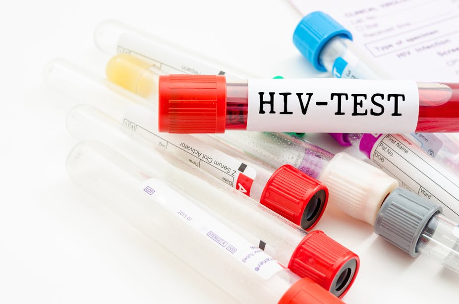 Blood vial with HIV test