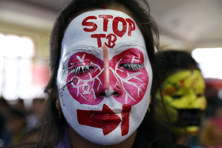 A woman wears face paint saying Stop TB
