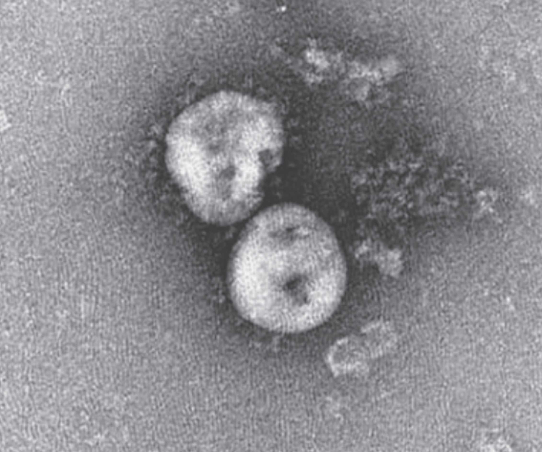 Guía definitiva para desmontar las dudas (y bulos) que rodean al coronavirus 1 Partículas virales de SARS-CoV-2, Na Zhu y colaboradores, 2020.