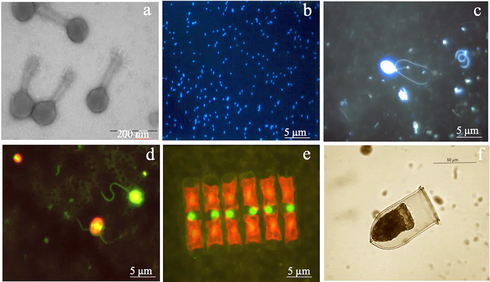 Marine viruses: the tiny microbes that orchestrate life in the ocean