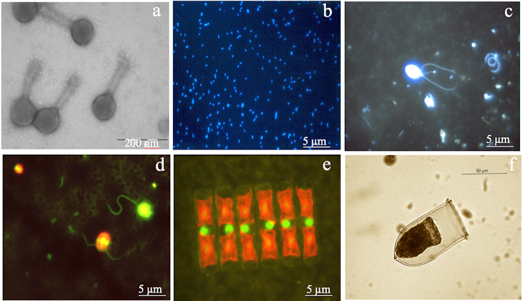 Marine viruses: the tiny microbe killers that orchestrate life in the ocean 16 Six panels depicting different microorganisms.