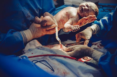 Cómo convertir las UCI neonatales en espacios más humanos 7 file 20210116 23 1cgp5un.jpg?ixlib=rb 1.1