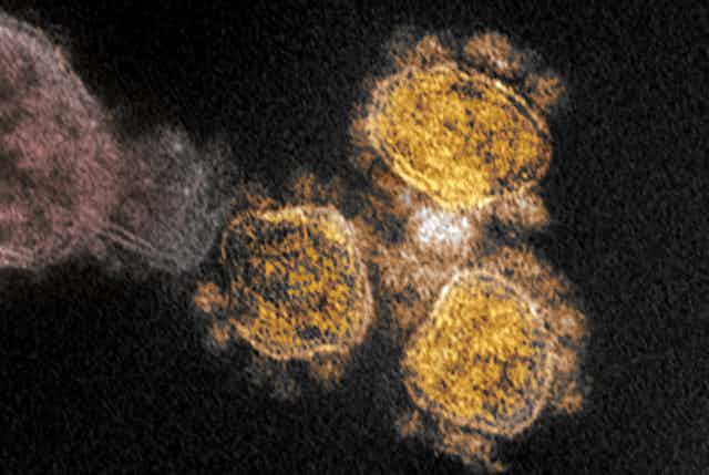 SARS-CoV-2 under an electron microscope