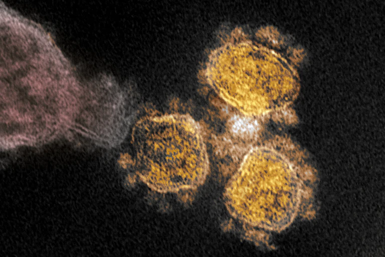 SARS-CoV-2 under an electron microscope