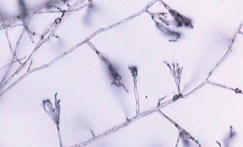 Serendipia, un hallazgo valioso en el diccionario 7 file 20210119 19 118pq3a.jpg?ixlib=rb 1.1