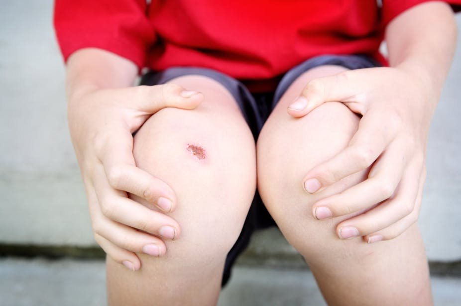 A boy has a scab on his knee.
