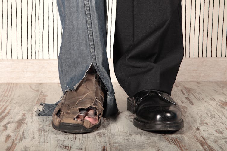 Man with one shiny shoe and one scruffy shoe