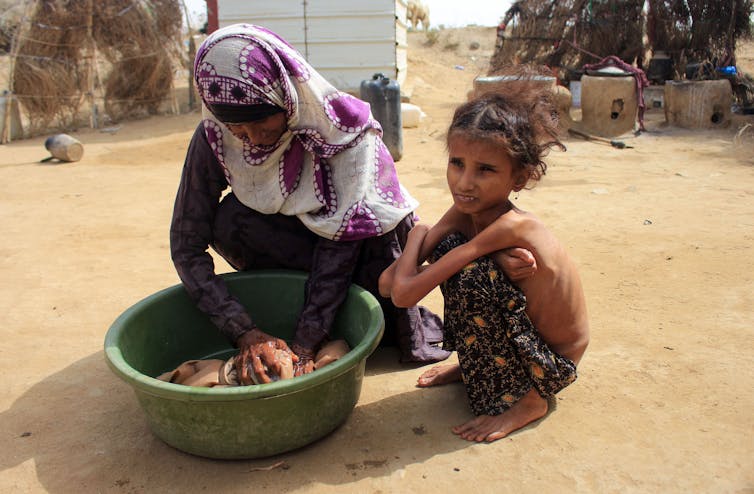 A extremely skinny 10-year-old child squats next to her mother, on the dirt ground