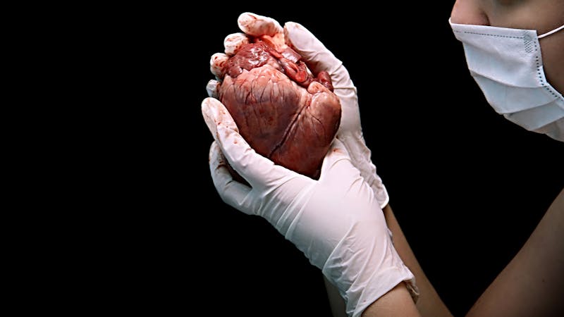 Así se repara un corazón ‘herido’ Así se repara un corazón ‘herido’