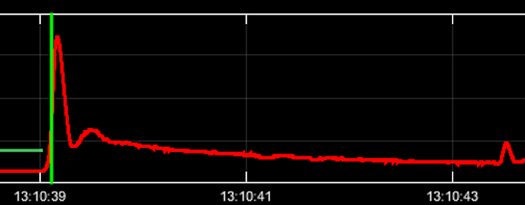 Heart monitor readout which indicates if a flatline occurs