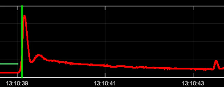 Heart monitor readout