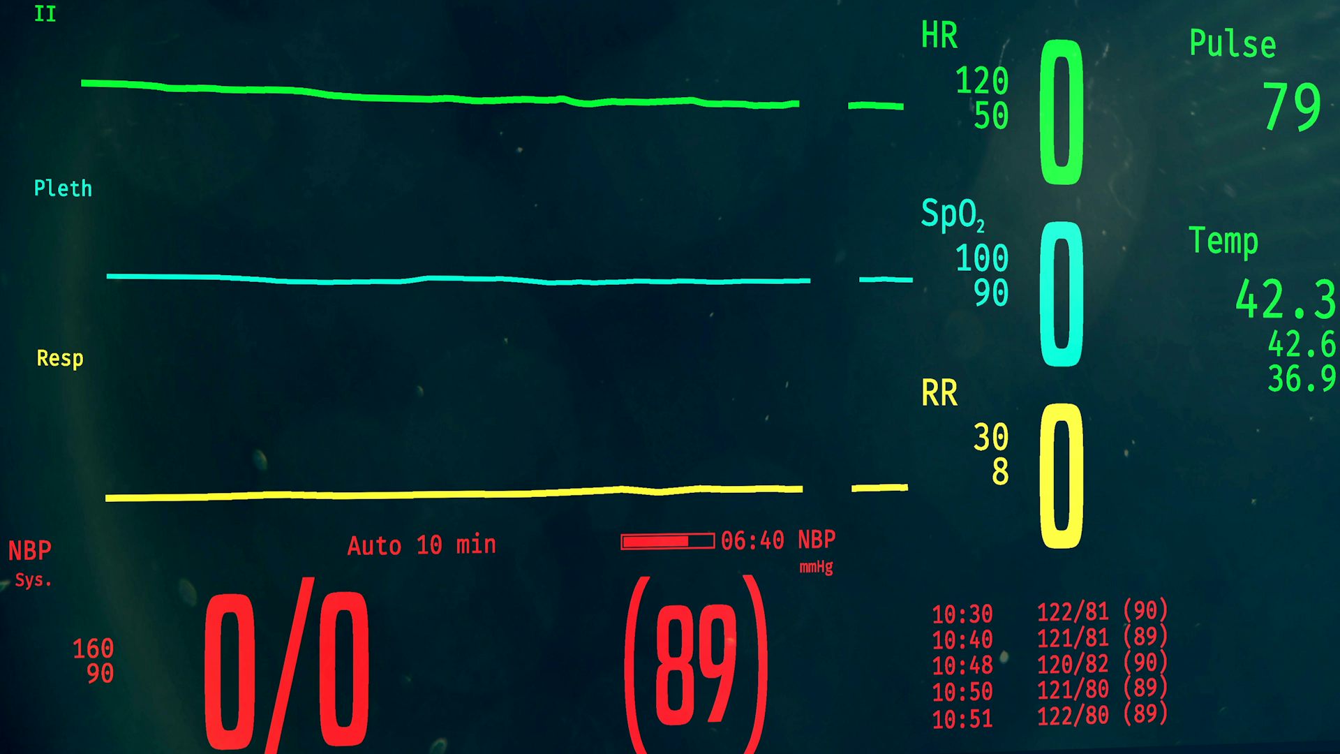 heart monitor flatlining