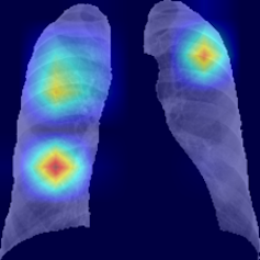 Rayos X e inteligencia artificial para evitar falsos negativos en el diagnóstico de la covid-19 21 file 20210129 19896 10b7oor.png?ixlib=rb 1.1