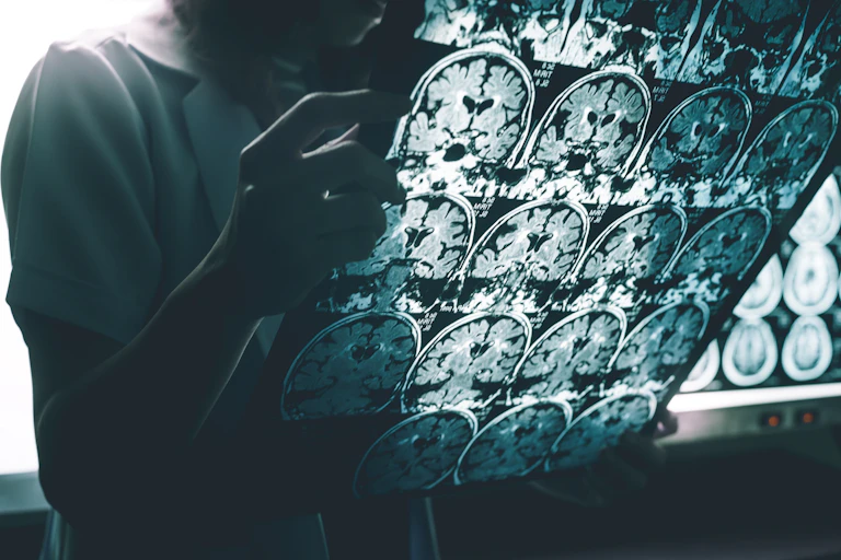 Nurse or doctor holding up brain scans.