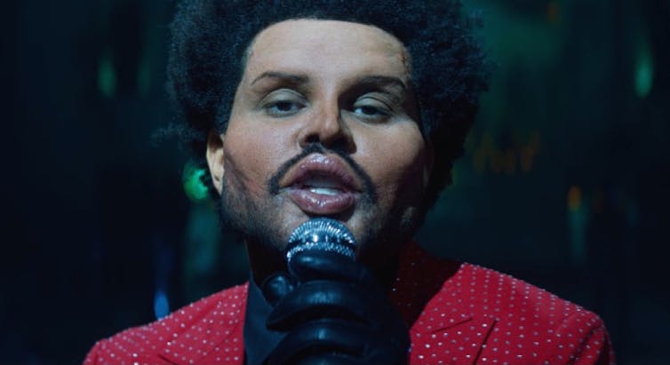 The Weeknd croons, his face swollen with prosthetics.