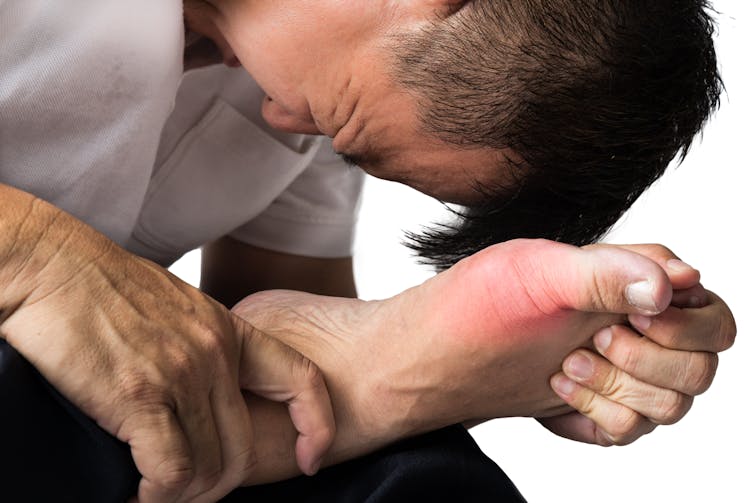 A main, appearing in pain, clutches his inflamed foot.
