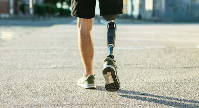 Homme avec une jambe artificielle. 