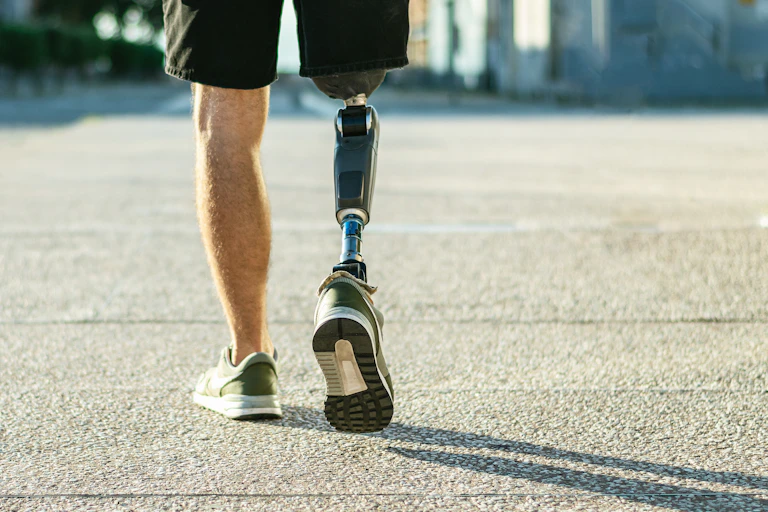 Homme avec une jambe artificielle.