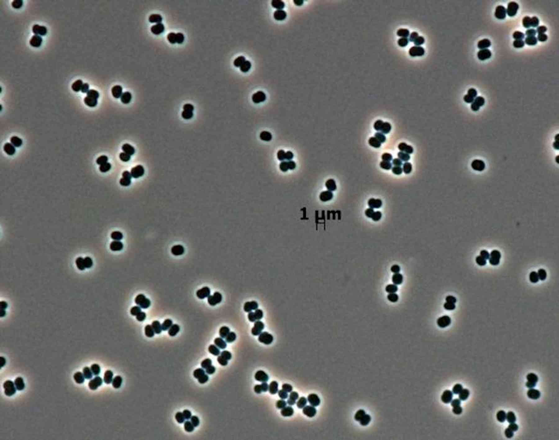Стерильные микроорганизмы. Tersicoccus Phoenicis. Bacillus safensis. Как выглядят микробы. Стерильная бактерия.