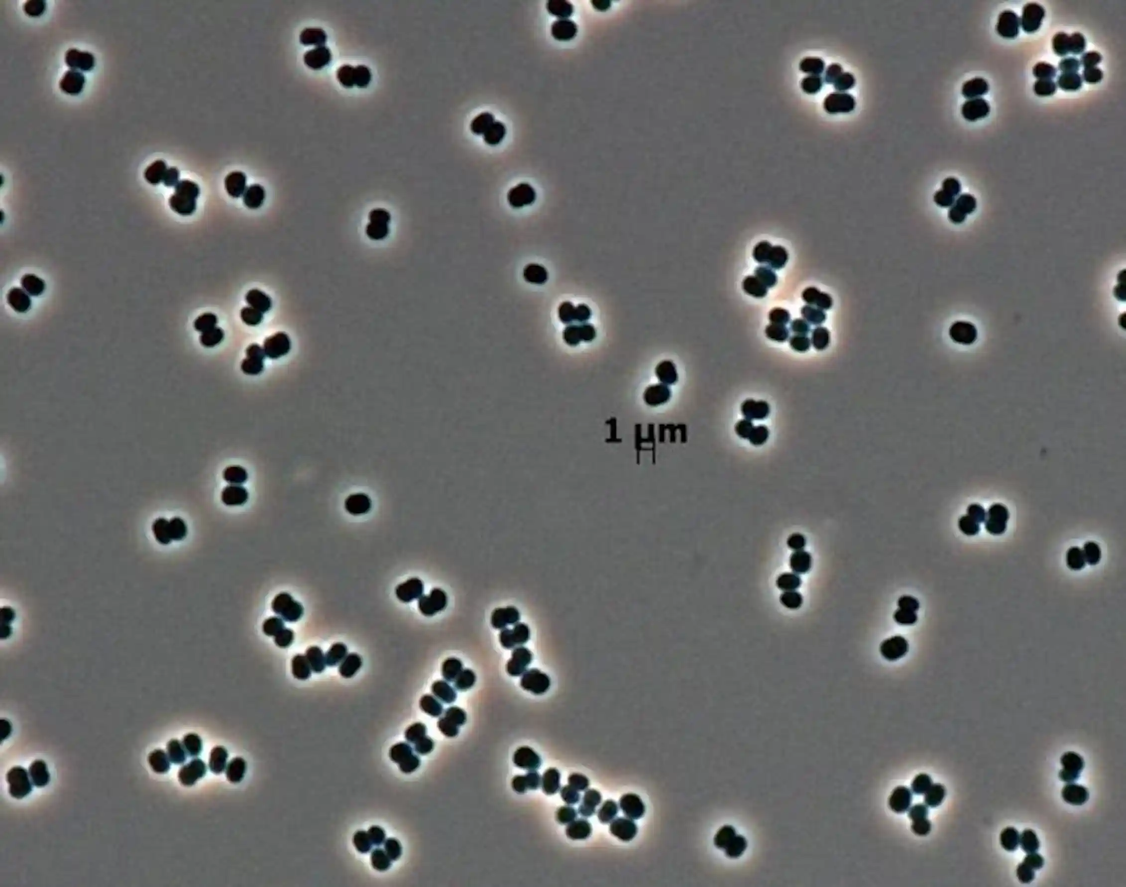 Mars Microbe Mars: how scientists prevent Earth’s microbes from contaminating other ...
