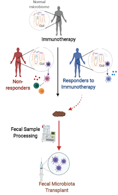 Fecal microbe transplants help cancer patients respond to immunotherapy and shrink tumors