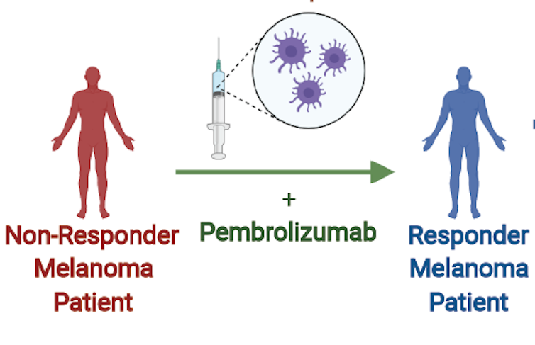 Fecal microbe transplants help cancer patients respond to immunotherapy and shrink tumors