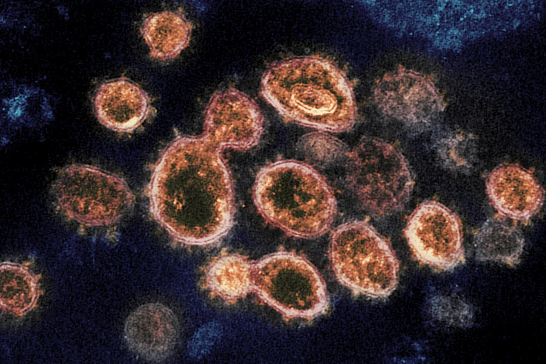 An electron microscope image of SARS-CoV-2 viral particles isolated from a patient