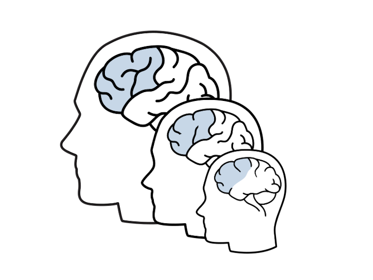 Diagram of brain.