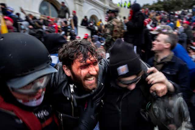 Trump supporter with a bloodied face grimacing in agony is helped out of a crowd at the Capitol by two protesters in riot gear