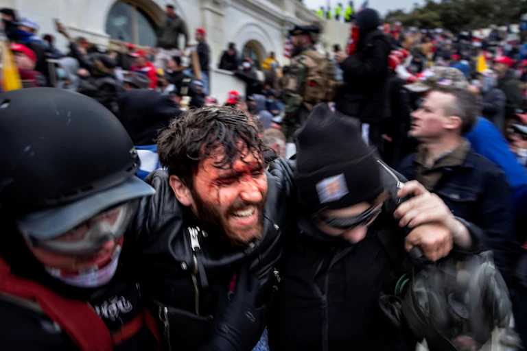 Trump supporter with a bloodied face grimacing in agony is helped out of a crowd at the Capitol by two protesters in riot gear