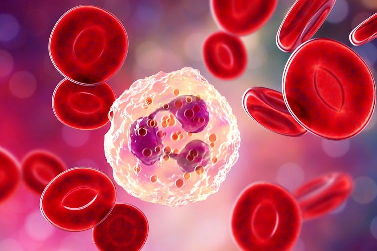 Neutrophil, shown in white, among red blood cells