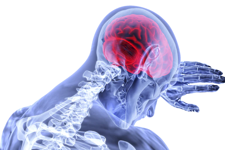 Les AVC ischémiques sont causés par une interruption du flux sanguin au cerveau.