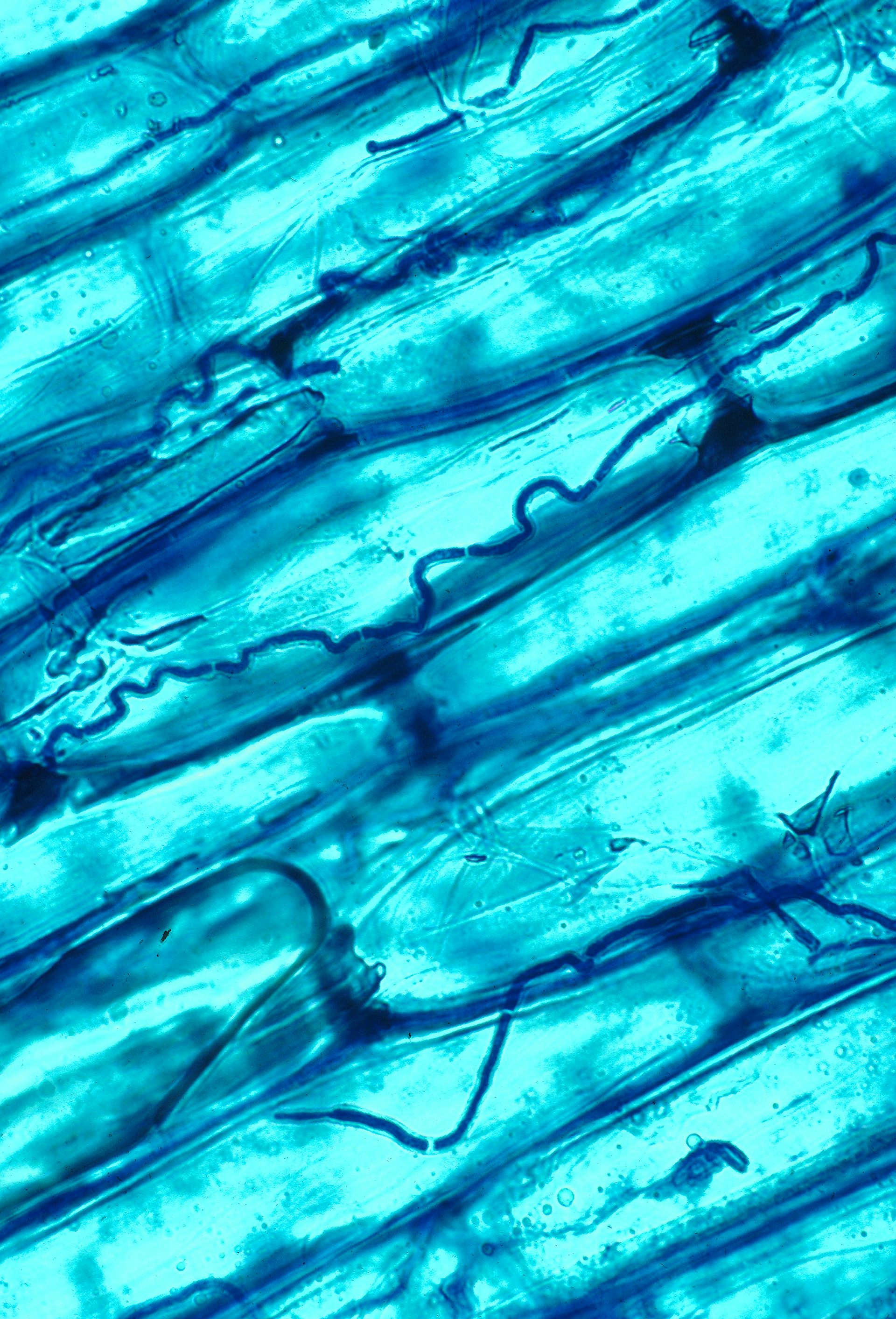 A microscopic organisms stained blue