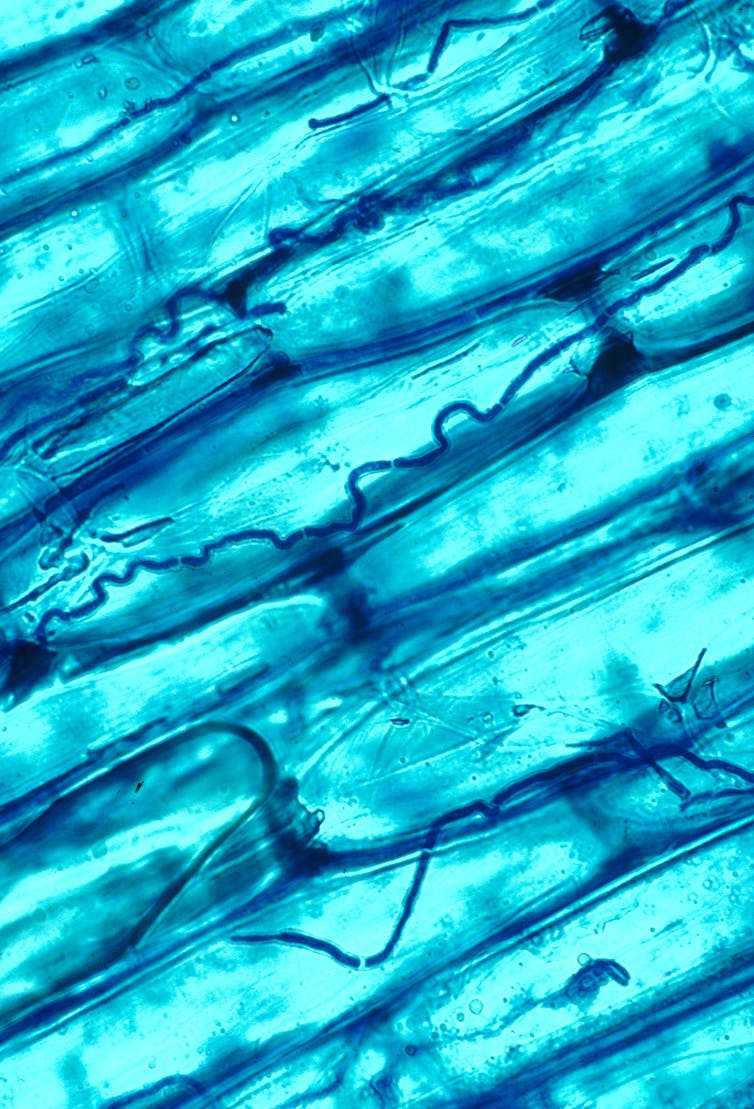 A microscopic organisms stained blue