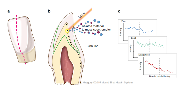 Diagram showing the process of laser-ablation mapping of teeth.