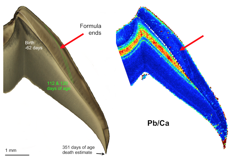 Teeth contain detailed records of lead contamination in humans and other primates