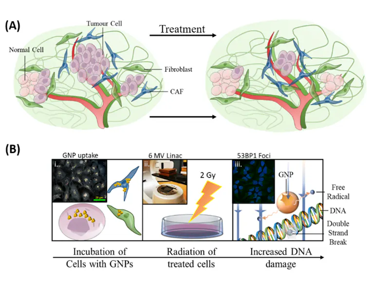 Illustration of the types of cells found in the microenvironment of a tumour.