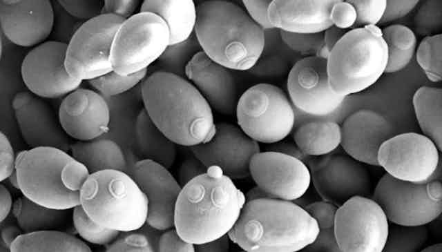 An electron microscope image of yeast in the genus Saccharomyces