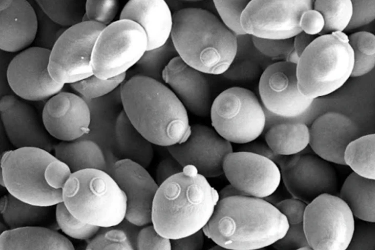 An electron microscope image of yeast in the genus Saccharomyces