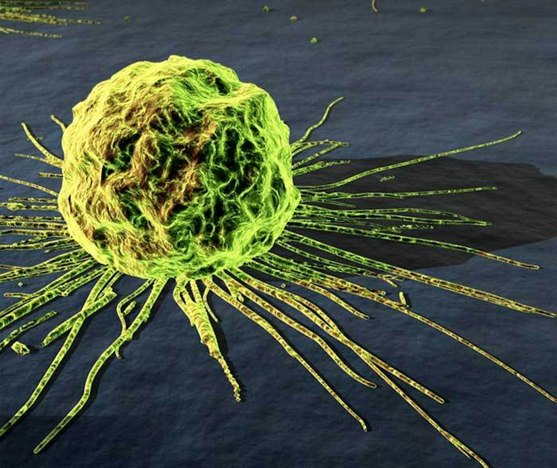 Nanoparticles cause cancer cells to die and stop spreading