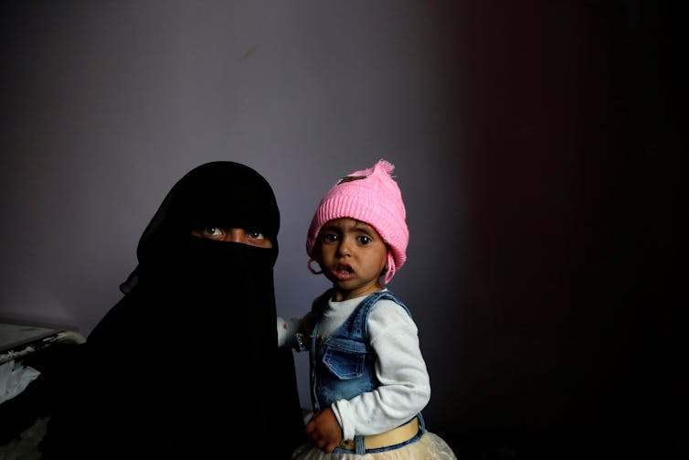 Femme en burqa noire est titulaire d'un enfant très maigre portant un chapeau rose, dans un hôpital