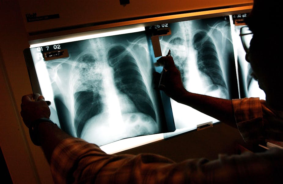 A doctor examines a patient x-ray