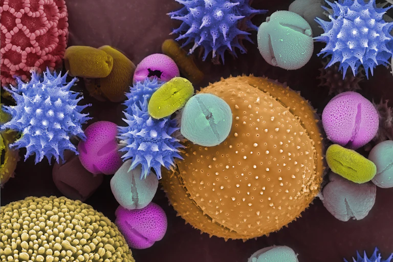 Pollen grains shown through a scanning electron microscope and colorized