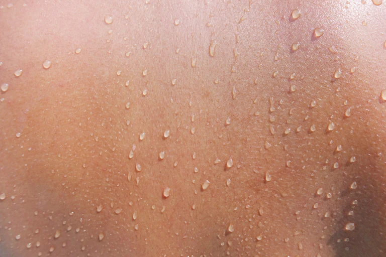 Piel con gotas de agua