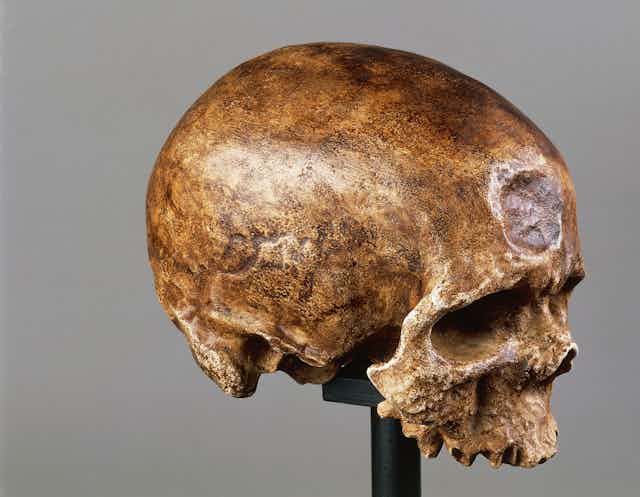 An old but intact skull