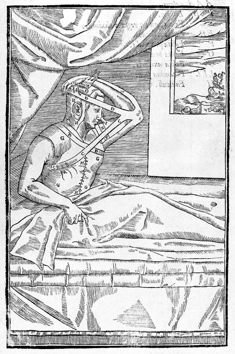 Black and white illustration of a man in bed with his arm attached to his head.