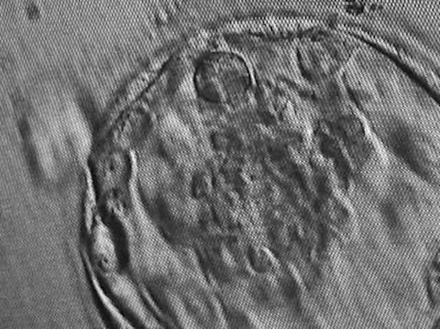 Microscope image of blastocyst