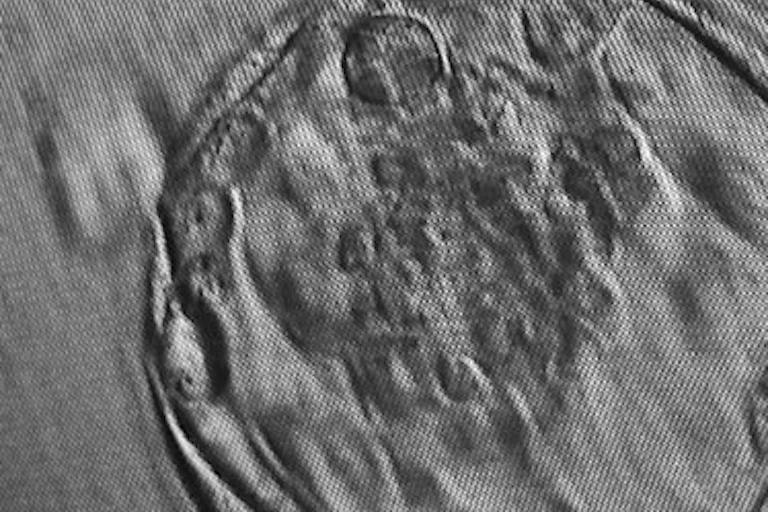 Microscope image of blastocyst