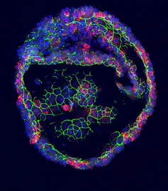 A close-up image of what looks like a cell, against a black background